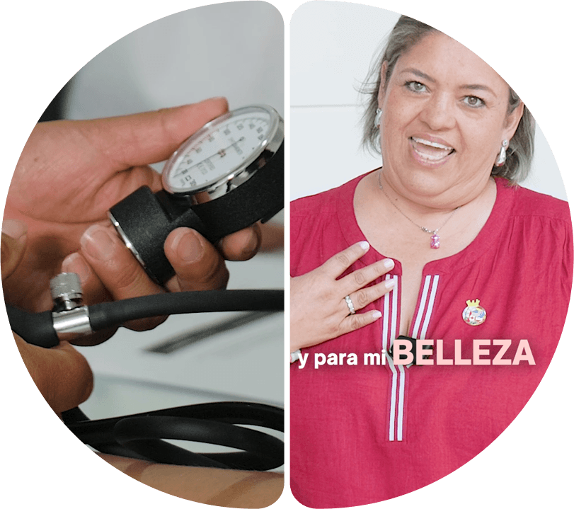 Antes y después — Revitalización y Relleno de Labios Premium